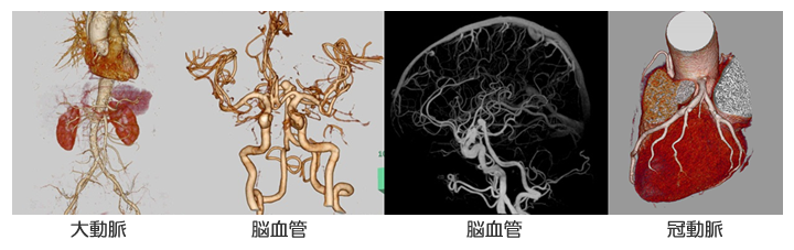 大動脈、脳血管、冠動脈の３Ｄ画像